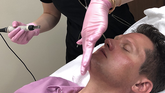 What is the difference between traditional Microneedling and Radio Frequency (RF) Microneedling?