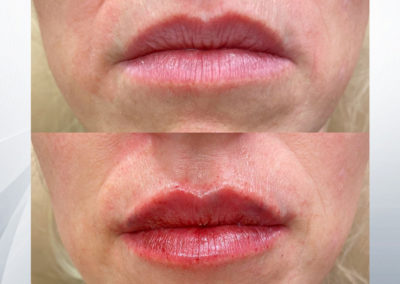 close-up of a person's lips