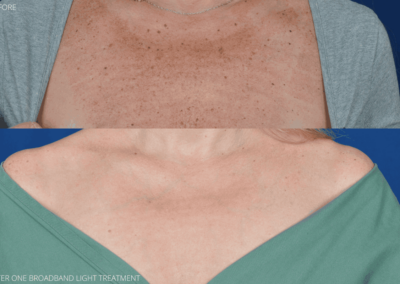 a close-up of a person's chest